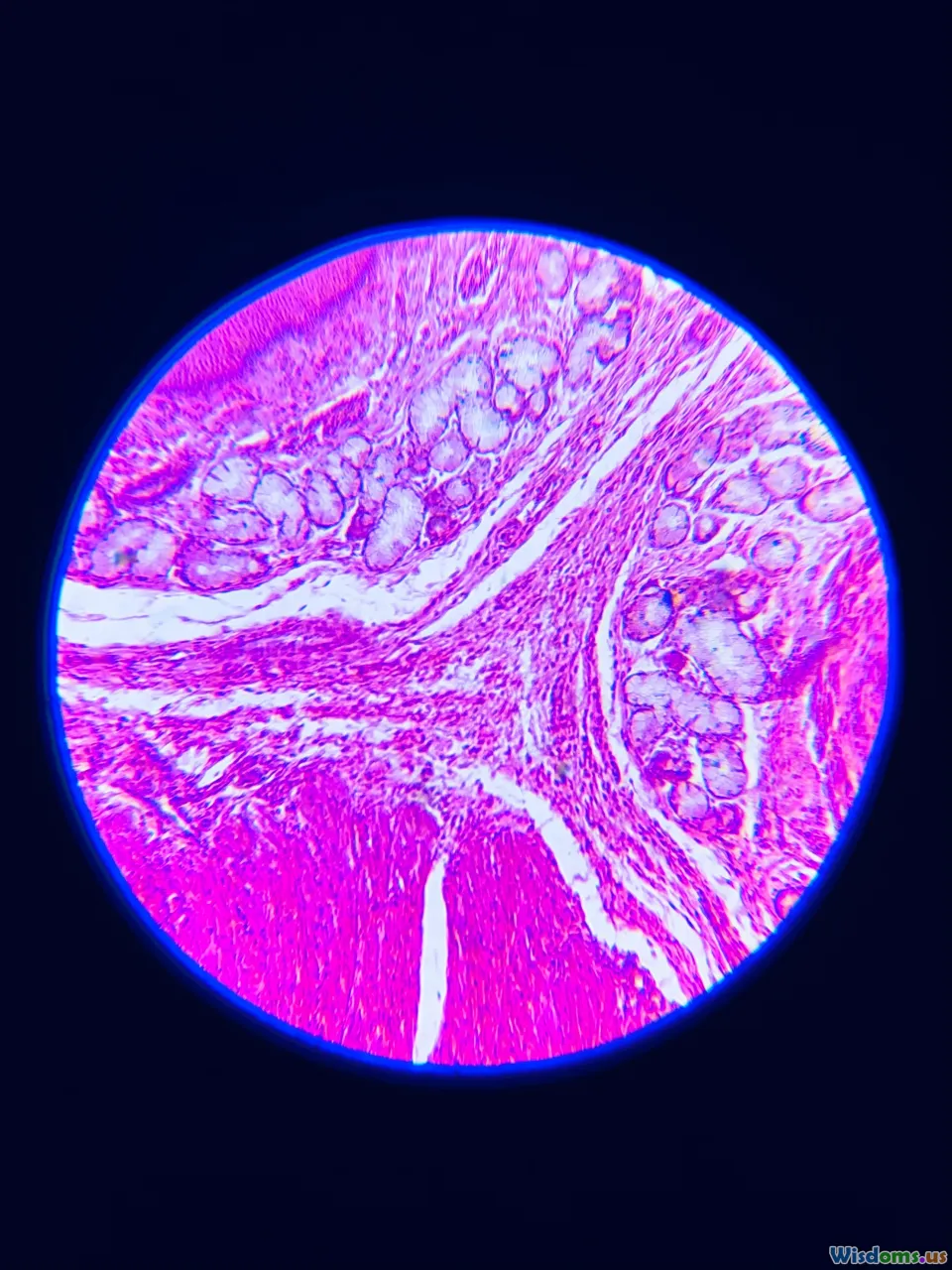 dermatology, microscope, skin layers